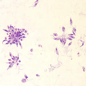 <p>Leishmania spp., promastigotes</p><p>Disease: <u>Leishmaniasis</u></p><p>Vector: <u>Sandfly</u></p><p>Infective stage: <u>Promastigote </u></p><p>Diagnostic stage: <u>Amastigote</u></p><p>Treatment: Amphotericin B</p>