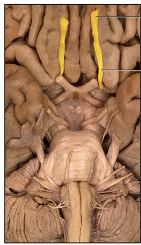 <p>Specimen of nerve [Image]?</p>