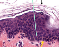 <p>Identify this area (yellow arrow)</p>