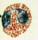 <p>What cell in the blood is shown?</p>