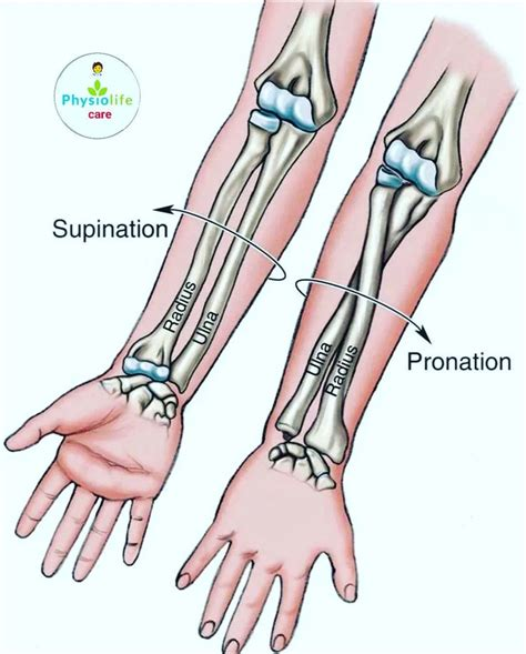 <p><strong>Pronation</strong> and supination of the hand are rotational movements which occur at the superior radioulnar joint.</p><p>These rotational movements are facilitated due to the presence of an annular ligament which holds the upper end of the radius in close apposition with the ulna. Since the upper radial end is freely mobile within the annular ligament, it allows the radius to rotate medially and laterally around the long axis of the ulna, bringing about <strong>pronation</strong> and supination movements.</p><p>For instance, if we place the forearm on a flat surface and flip the hand such that the palm faces downwards, this is <strong>pronation</strong>. Here, the distal end of radial bone has rotated medially over the ulna. On the contrary, if we bring the hand back to its original position with palm facing upwards, this is supination movement. In this case, the distal radius has rotated laterally over the ulna.</p><p>Two major pronators of the forearm are pronator teres and pronator quadratus muscles.</p>