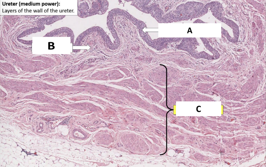 <p>Name the structure indicated by C.</p>