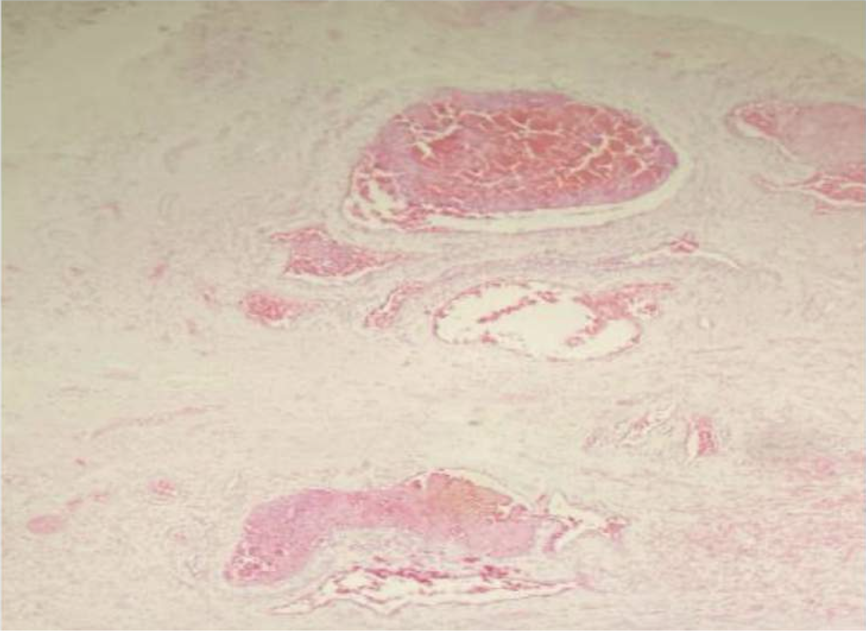 <p>Identify</p>