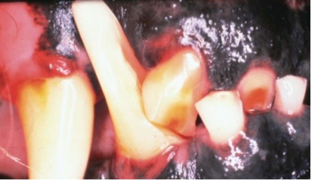 <p><span style="background-color: transparent;">Identify this pathology and explain its etiology</span></p>