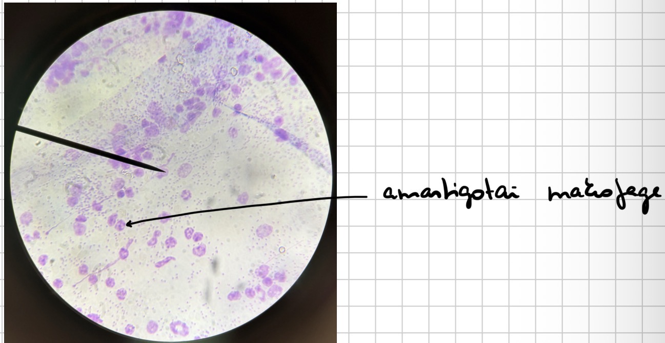 <p>Leišmanijos - leishmania (amasrigotai makrofage)</p>