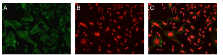 <p>uses fluorophores (flourescent dyes/proteins)</p><p>uses UV light —> excites fluorophores at diff wavelengths —> glow diff colors (wide variety)</p><p>dark background, bright colored objects</p><ul><li><p>ex: GFP, RFP, YFP</p></li><li><p>used to locate specific proteins, detect antibodies</p></li><li><p>can’t visualize intracellular structures</p></li></ul><p></p>