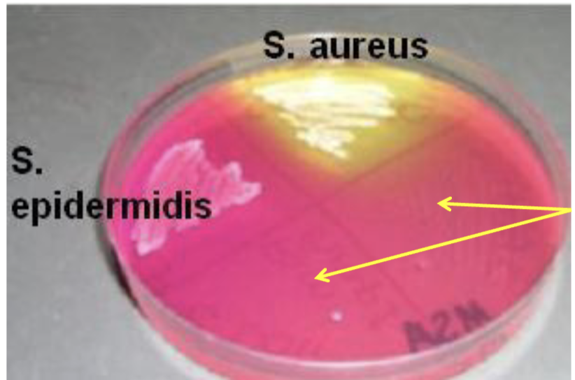 <p>bacteria <strong>NAME GENUS SPECIES </strong>that does <strong>not</strong> grow?</p>