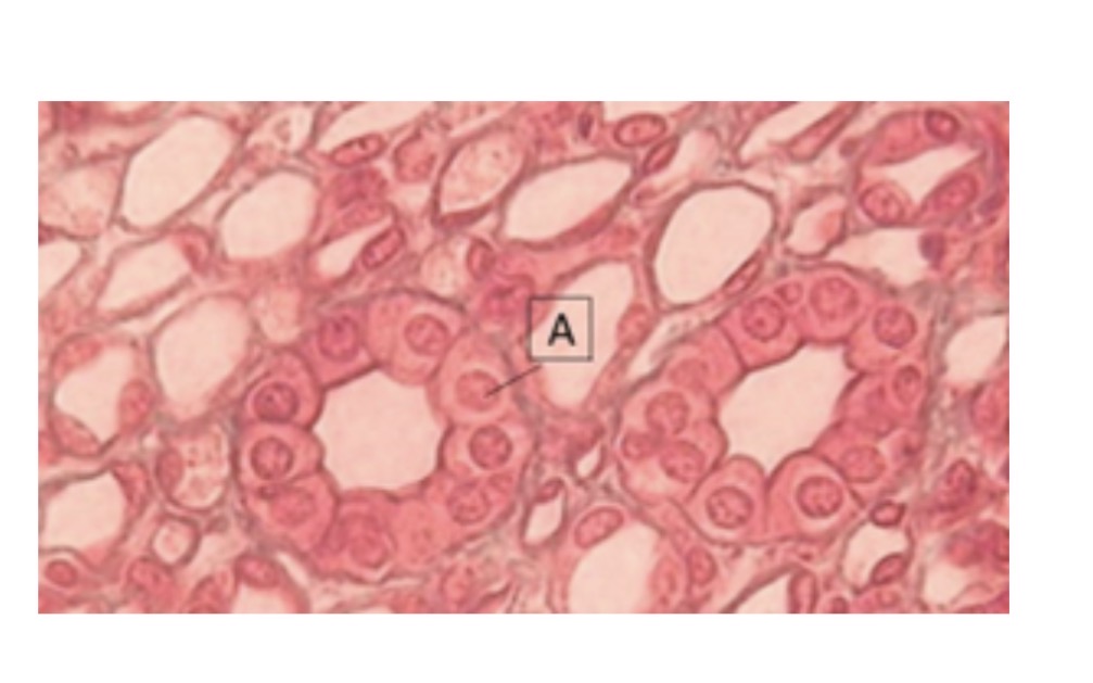 <p><span>Identify this epithelial tissue.</span></p>