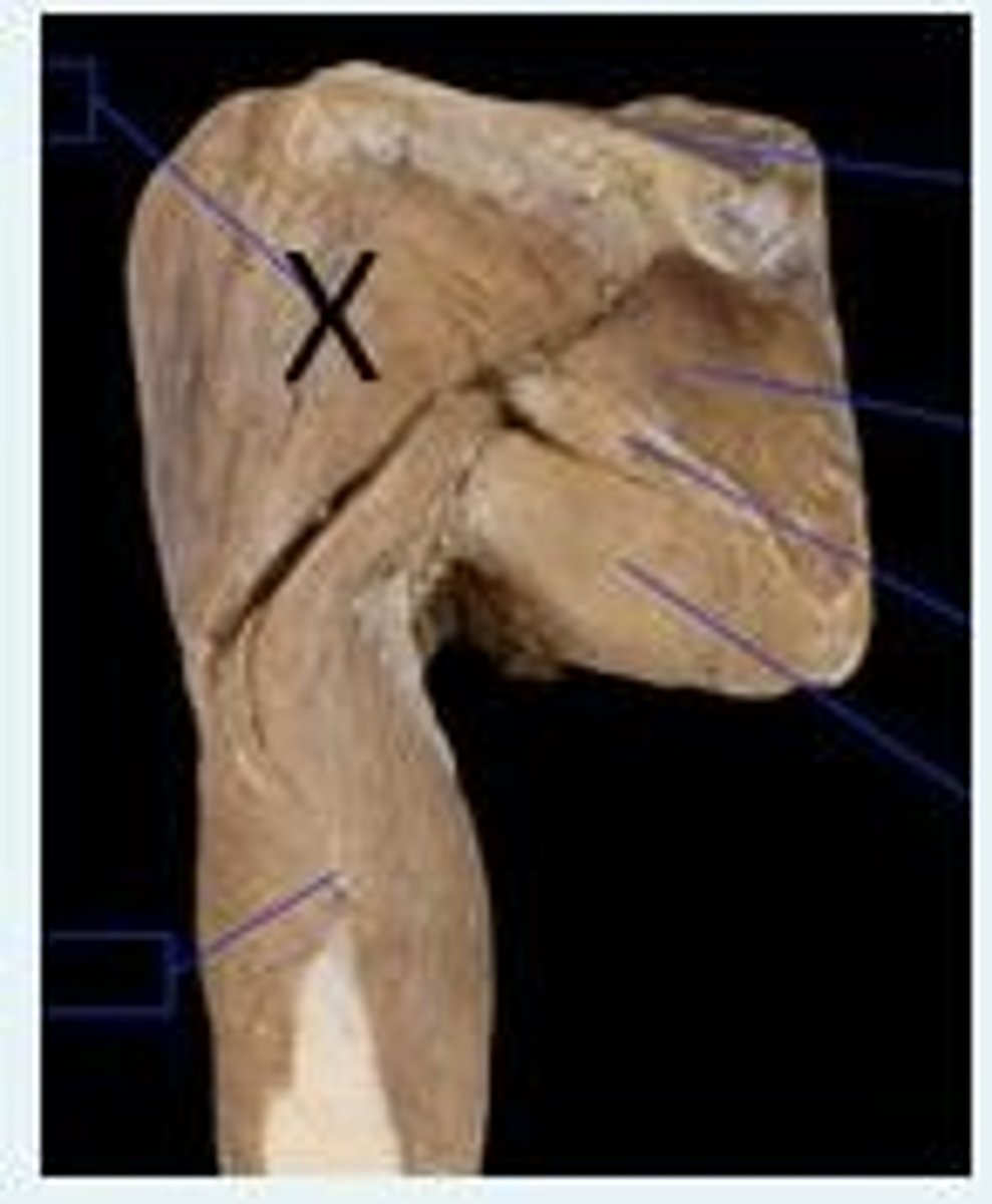 <p>The muscle labelled X in the image above is the ___ muscle.</p><p>The nerve that supplies this muscle is the ___ nerve.</p>