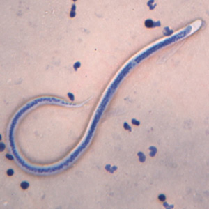 <p>What adult roundworm is this?</p>