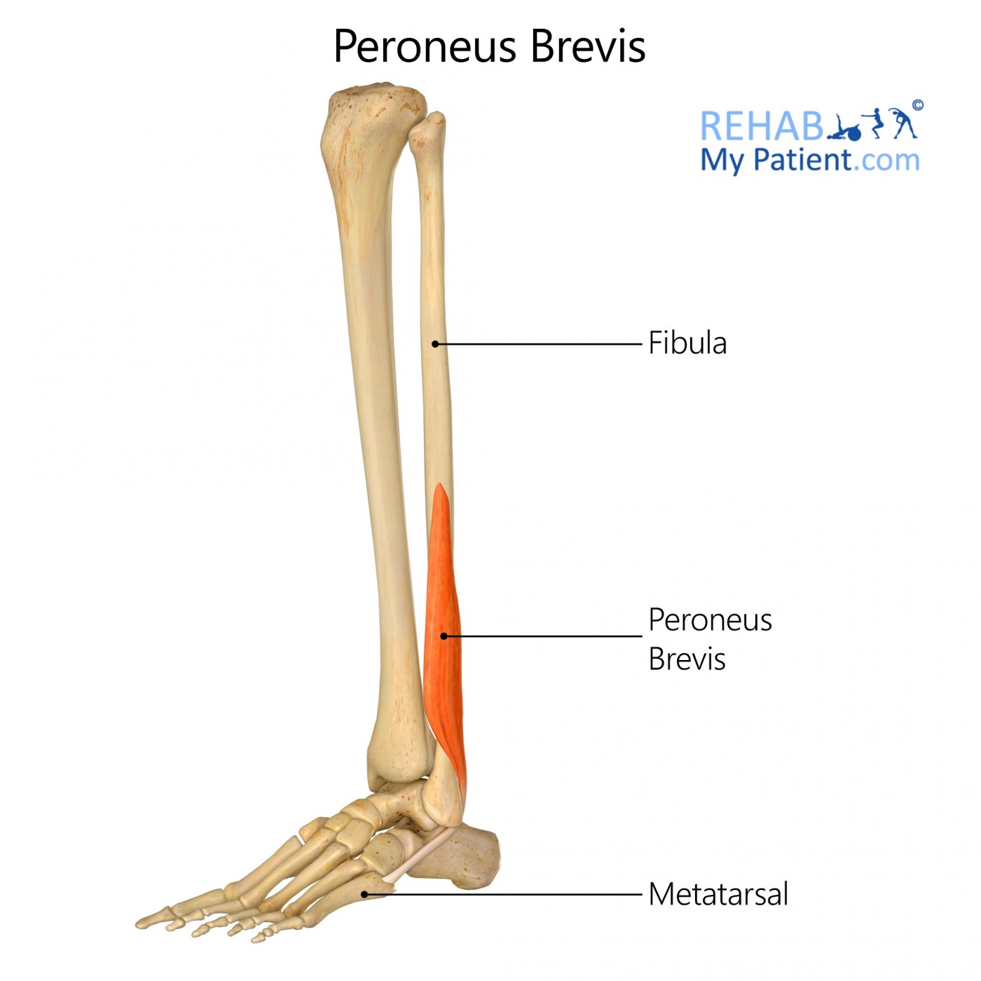 <p>tuberosity on the lateral surface of the base of the 5th metatarsal</p>