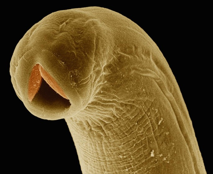 <p>New world hookworm? Cutting plates (more “modern” look - two teeth)</p><p>Route of infection = wound/lesion of skin → blood → lungs → small bowel</p>