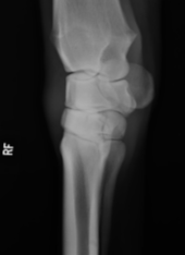 <p>Which radiographic view is this?</p>