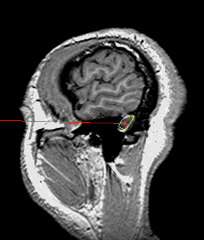 <p>What is the area highlighted called?</p>