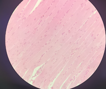 <p>Tongue (lingua) - HE</p><ul><li><p><strong>Epithelium:</strong> <strong>Stratified squamous</strong> (non-keratinized).</p></li></ul><ul><li><p><strong>Papillae:</strong> Highly <strong>deep structures</strong> containing <strong>taste buds</strong>.</p></li><li><p><strong>Tunica Submucosa:</strong> Contains <strong>serous glands</strong> (circular nuclei) and <strong>mucous glands</strong>.</p></li><li><p><strong>Muscle Cells:</strong> <strong>Rhabdomyocytes</strong> (striated voluntary muscle).</p></li><li><p><strong>Nuclei:</strong> Up to <strong>100 nuclei</strong> per cell, located <strong>underneath the sarcolemma</strong> (plasma membrane).</p></li><li><p><strong>Connective Tissue Sheets:</strong> <strong>Endomysium</strong> (individual cells), <strong>perimysium</strong> (bundles), and <strong>epimysium</strong> (whole muscle)</p></li></ul><p><br></p>