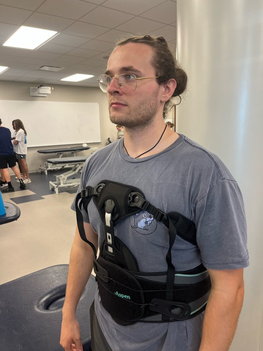 <p>**thoracic or upper lumbar compression fx</p><p>**post op spinal fusion</p><p>**trauma- wedge fx</p>