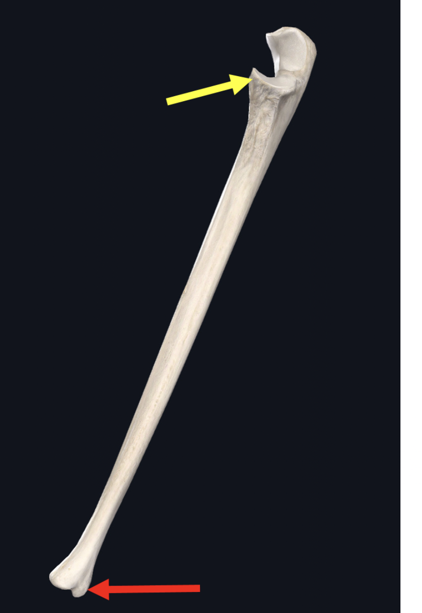 <p><span>identify the structure at the tip of the yellow arrow</span></p>