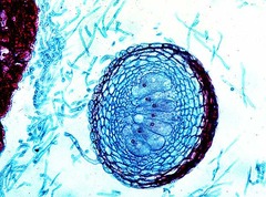 <p>A completely closed ascocarp.</p>