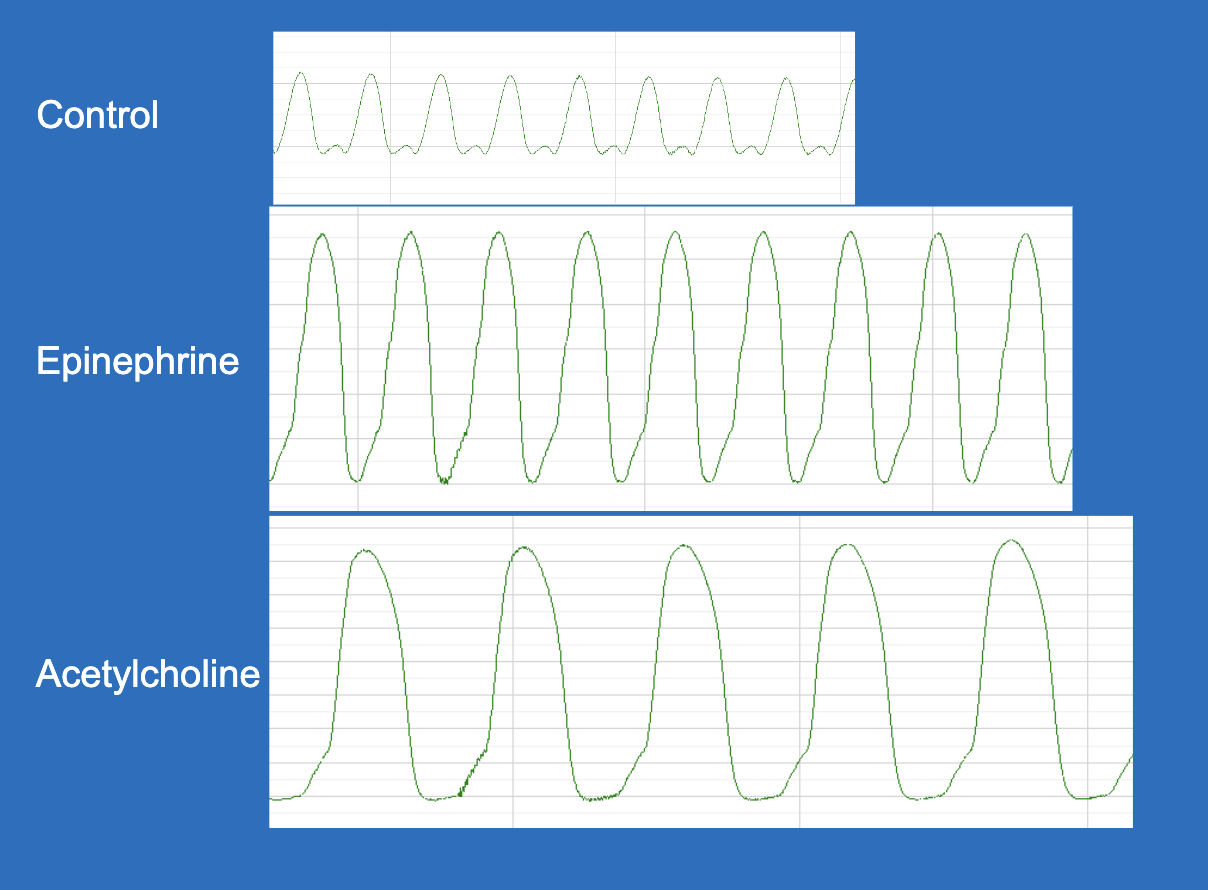 <p>control, epinephrine, and acetylcholine</p>