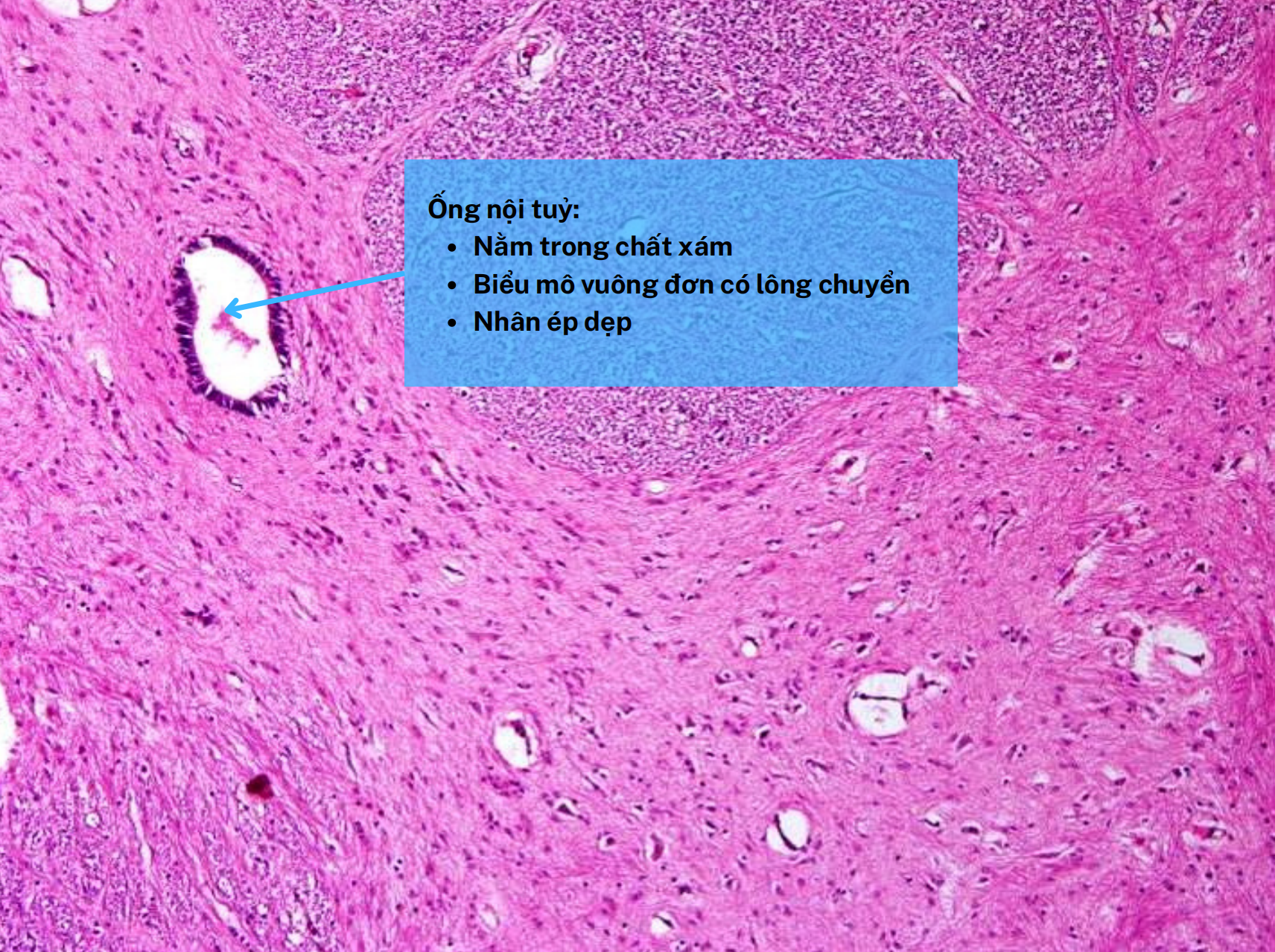 <p>Biểu mô vuông đơn có lông chuyển</p>