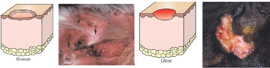 <ul><li><p><strong>secondary lesions</strong></p></li><li><p>clinically look similar</p></li><li><p>erosion = partial thickness epidermal defect</p></li><li><p>ulcer = full thickness epidermal defect</p></li></ul><p></p>