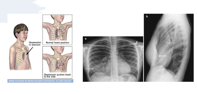 <p>what pathology is this?</p>