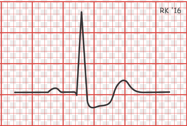 <p>What is the following condition? </p>