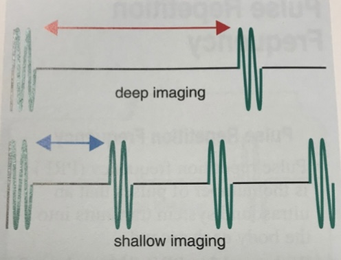 <p>What parameter is this image?</p>