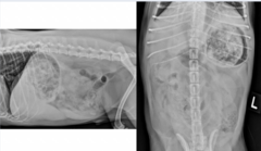 <p>What abnormality is seen in this image?</p>