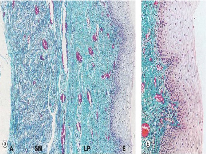 <p>Identify :</p><p>Mention histological features :</p>
