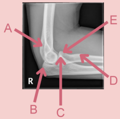 <p>What view of the elbow is this?</p>