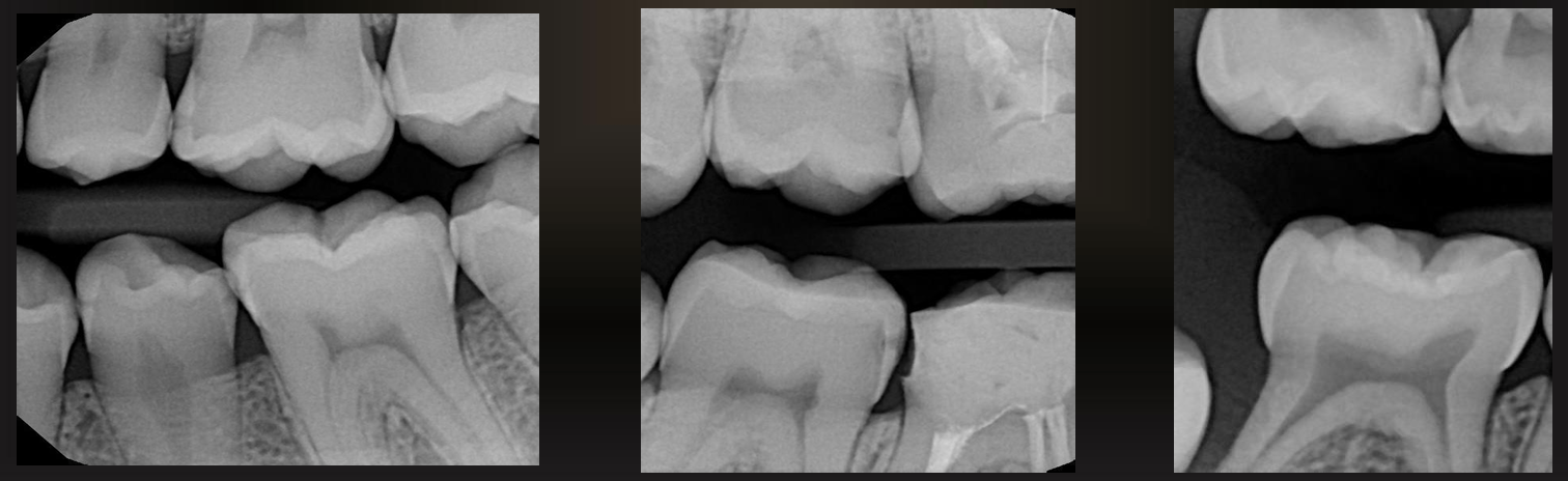 <p>what do these images have?</p>