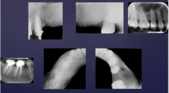 <p>describe the appearance of the lesions:</p>