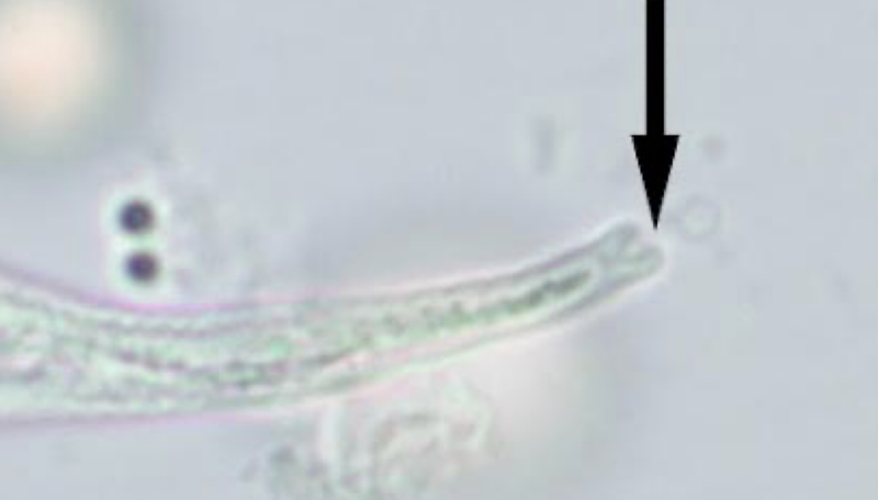 <p>what helminth is this?</p>