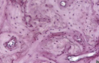 <p>ID the bone type</p>