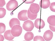 <p><span style="background-color: rgba(0, 0, 0, 0); line-height: 19.55px;">small pieces of cells that look like “junk” on the side</span></p>