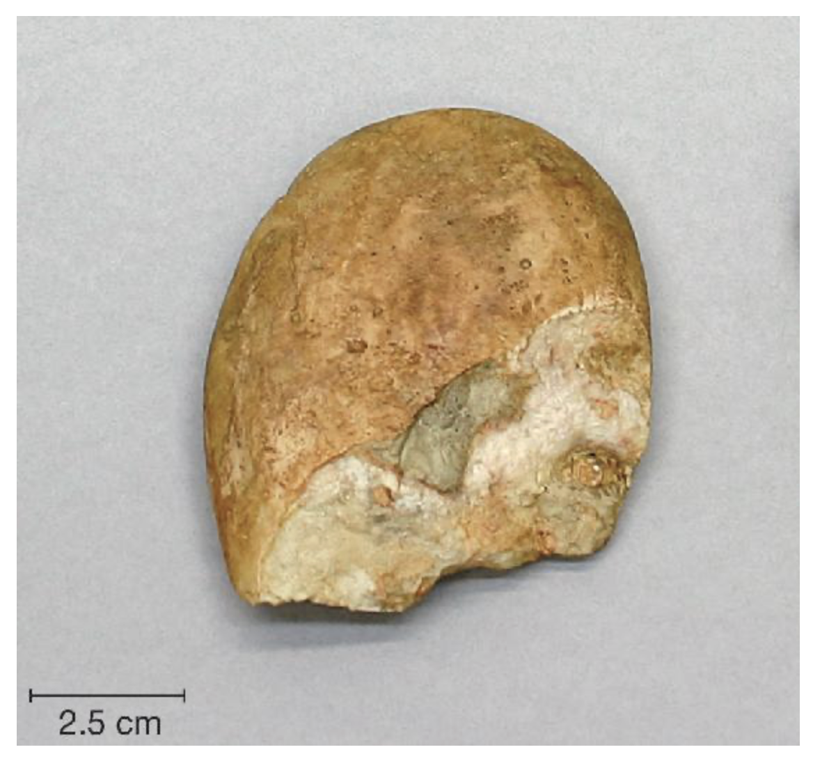 <ul><li><p>Named after earliest ones being found in Olduvai Gorge</p></li><li><p><span style="background-color: transparent;">Au. garhi potentially used some of these (animal bones with cut marks found in Au. garhi site in Ethiopia + stone tools found dated around the same time as Au. garhi)</span></p></li><li><p><span style="background-color: transparent;">Two main types of tools</span></p><ul><li><p><span style="background-color: transparent;"><strong>Choppers</strong> → large, heavy tools with a small sharp edges, used to break bones</span></p></li><li><p><span style="background-color: transparent;"><strong>Flake</strong>s → bits of rock that are removed from choppers, used to scrape meat</span></p></li></ul></li></ul><ul><li><p><span style="background-color: transparent;">Produced by “direct percussion” (two stones are hit together to break off flakes)</span></p></li><li><p><span style="background-color: transparent;">Vary in size, shape, &amp; raw material</span></p></li></ul><p></p>