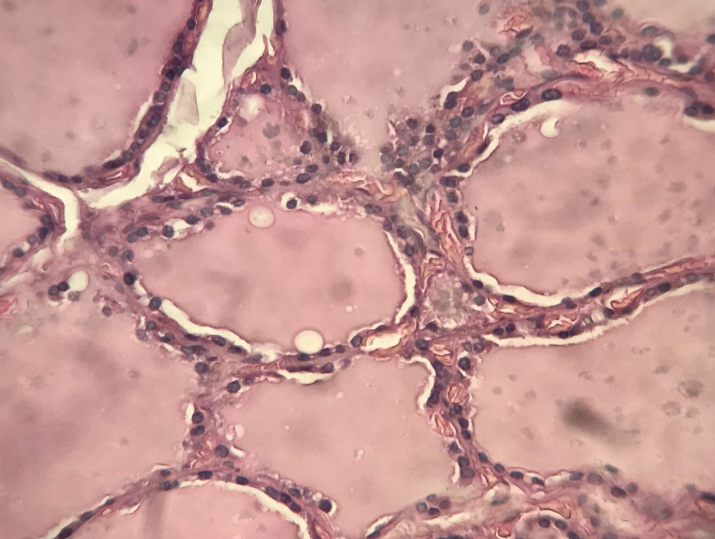 <p>thyroid gland: follicular cells, thyroid follicle, colloid, parafollicular cells</p>