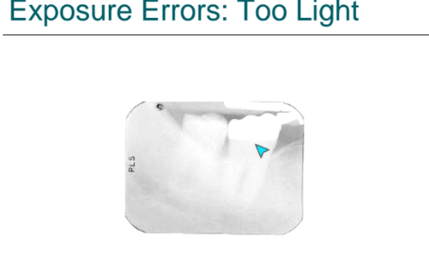 <p>What causes an image to be too light?</p>