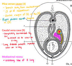 <p>a small pleural space medial to the plica venae cavae.</p><p>it is occupied by the accessory lobe of the lung</p>