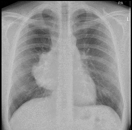 <p><span>Male. 22 years. Loss of weight and generalised weakness</span></p>