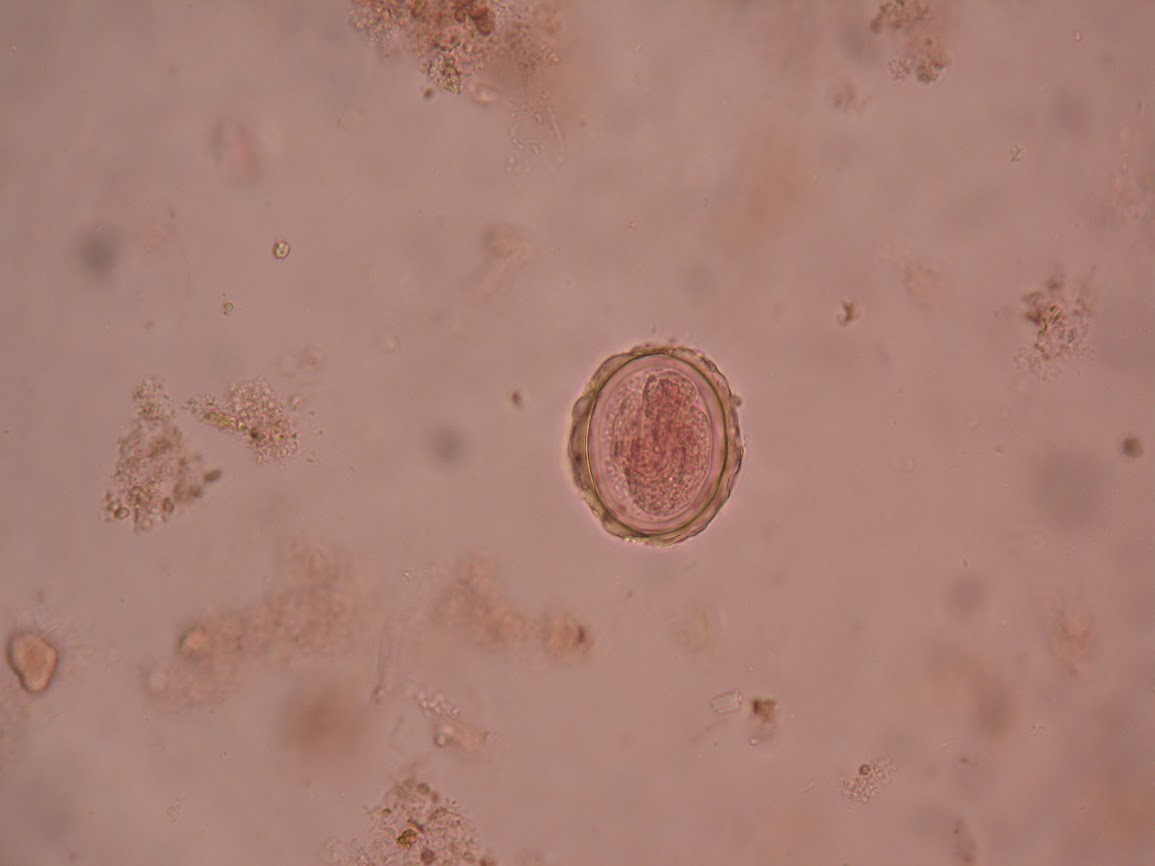<p>Identify this roundworm</p>