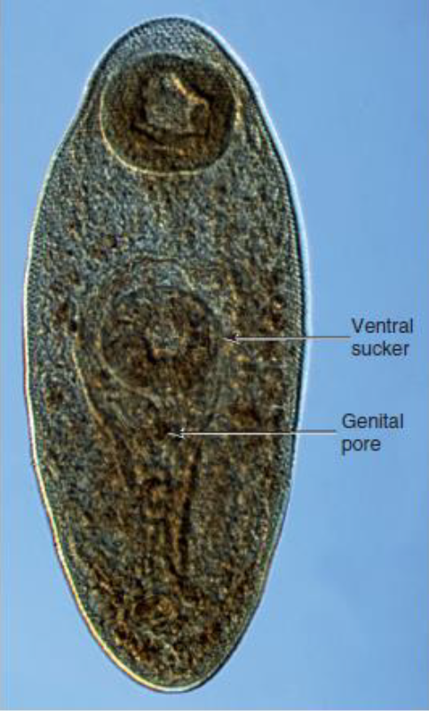 <p>Name this Trematode</p>