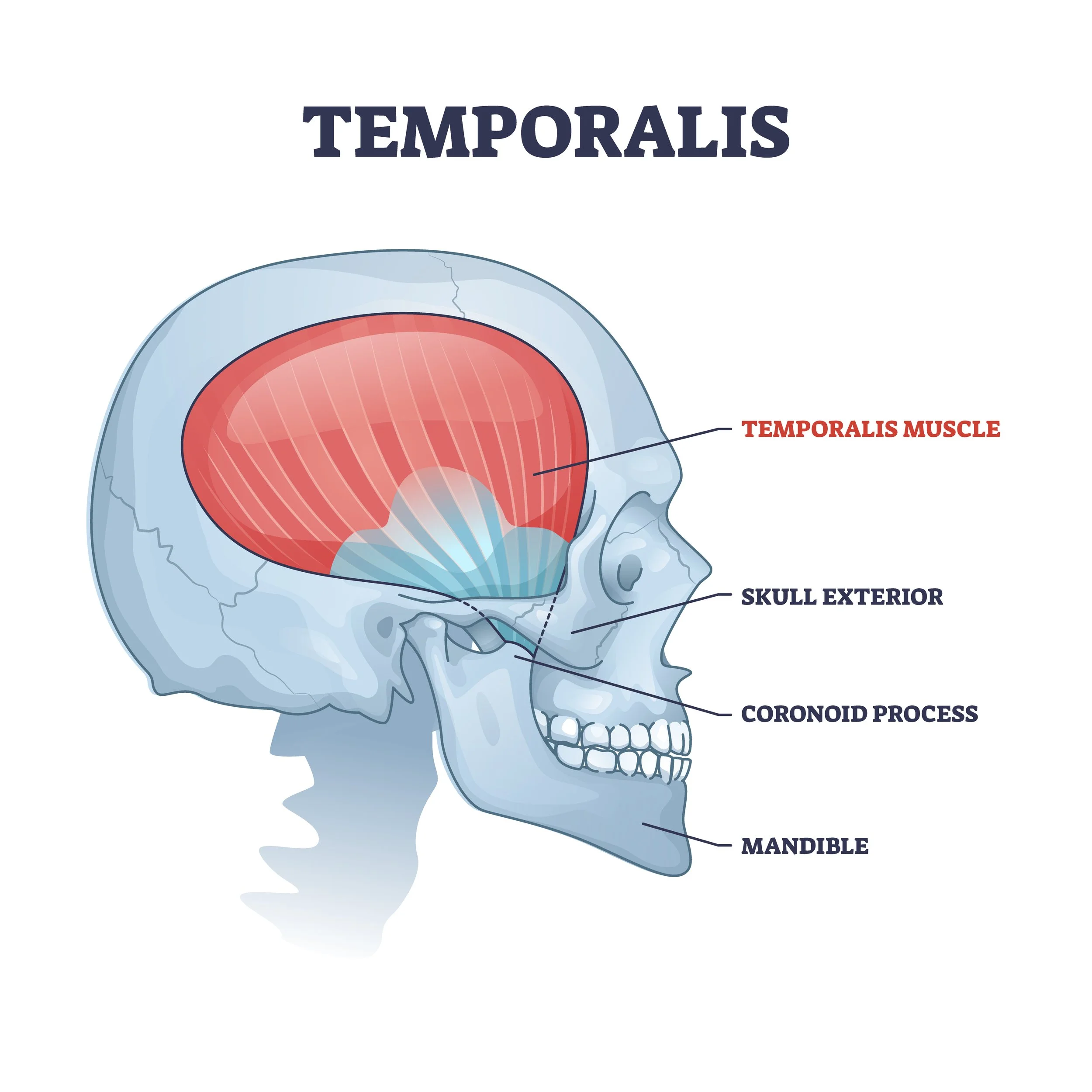 <p>Origin- Lateral skull</p><p>Insertion- Coronoid process of the mandible</p>