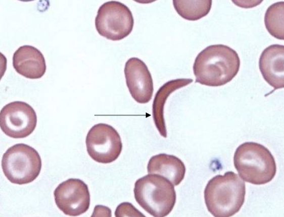 <p>name the type of RBC</p>