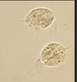 <p>Looks similar to WBC, must be moving to call</p>