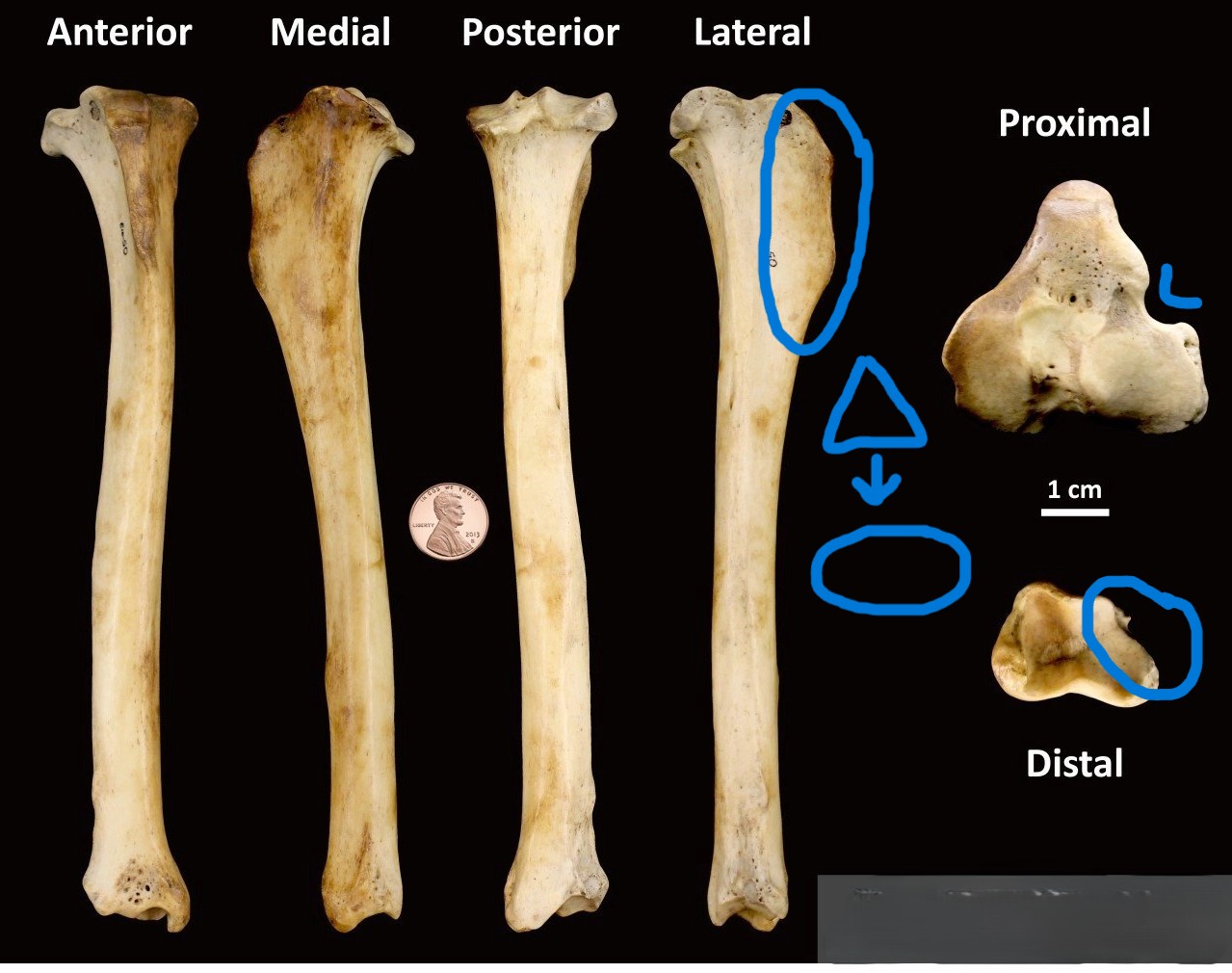 <ul><li><p>small U-shaped notch</p></li><li><p>undercut distal articulation (looks cut-off)</p></li><li><p>triangular proximal cross-section → oval distal cross-section</p></li><li><p>crest</p></li></ul><p></p><p>dog tibia </p><p></p>