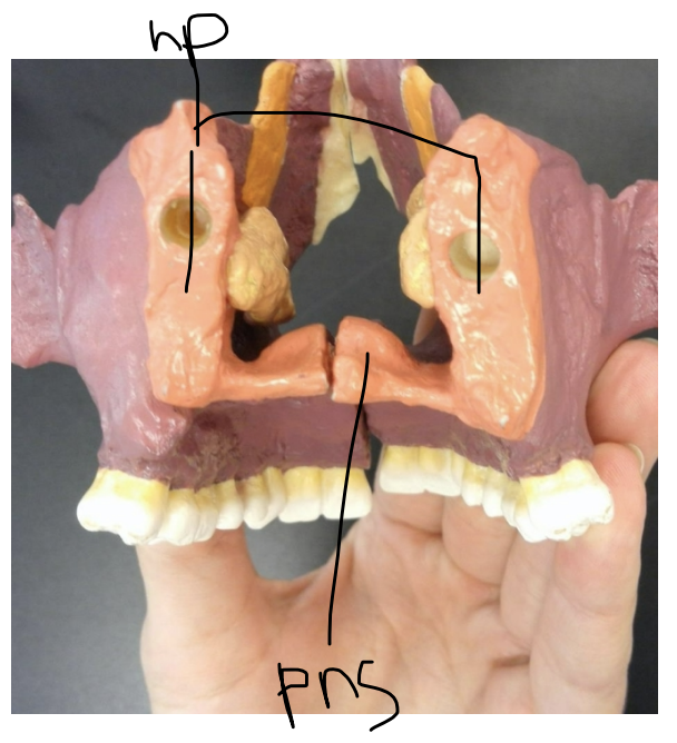 <p>Posterior nasal spine of the palatine bone</p>