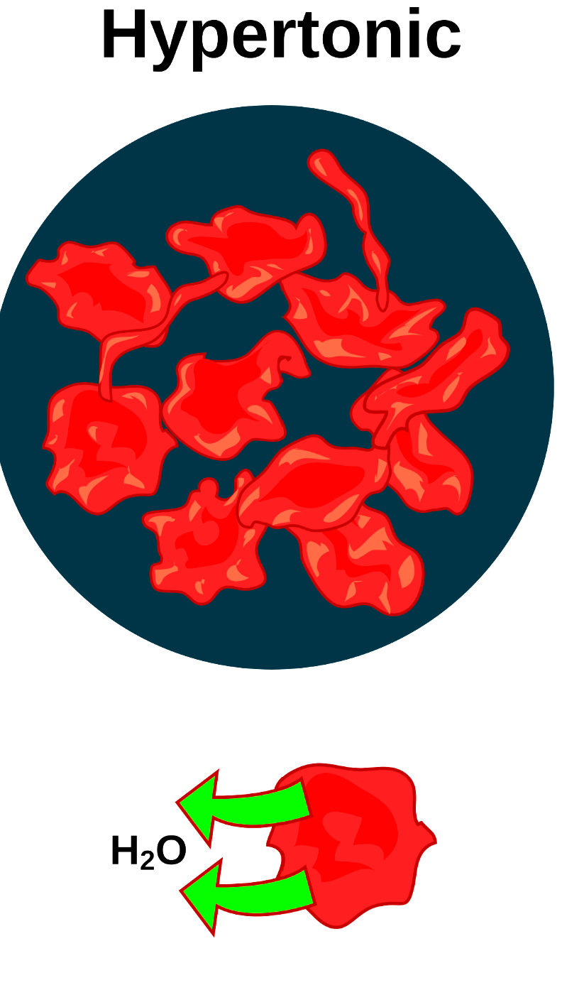 <p>The concentration of solutes on the outside of the cell is higher than inside the cell</p>