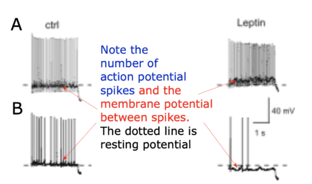 <p>Transplanted hypothamic neurons respond to Leptin properly. Which neuron exports K+ as a function of leptin interaction?</p>